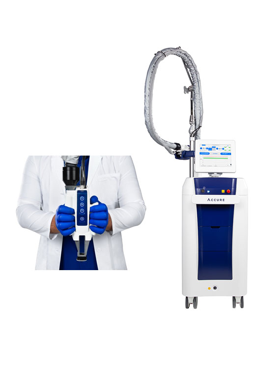 laser-acne-accure