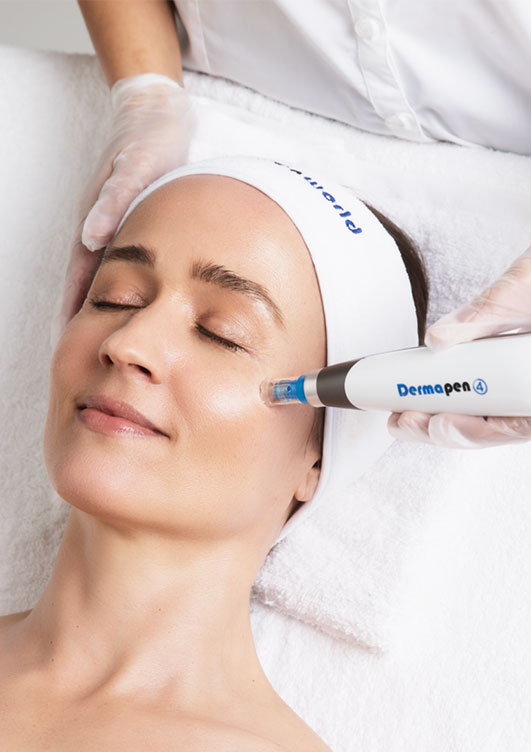 microneedling-con-dermapen